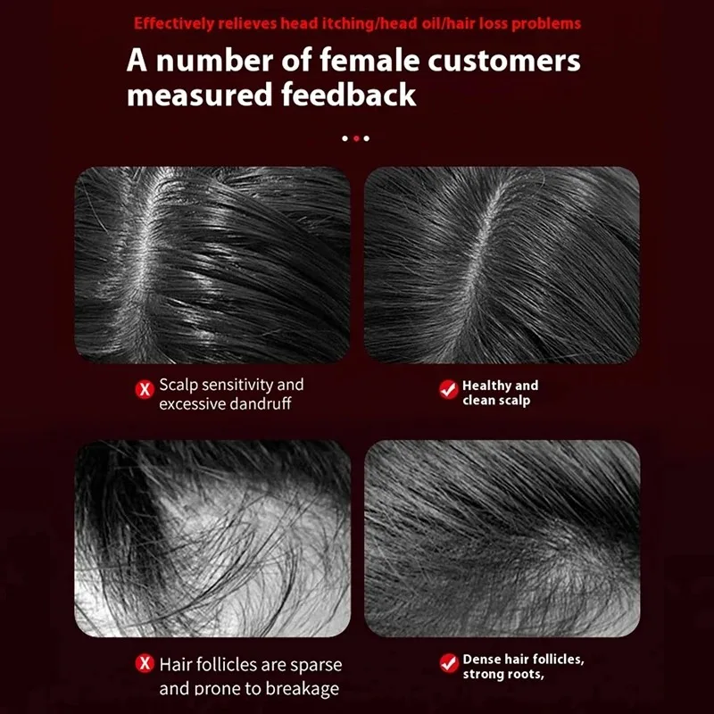 Electric Vibration Massage Com - Hair Care For Hair Growth 评论和价格