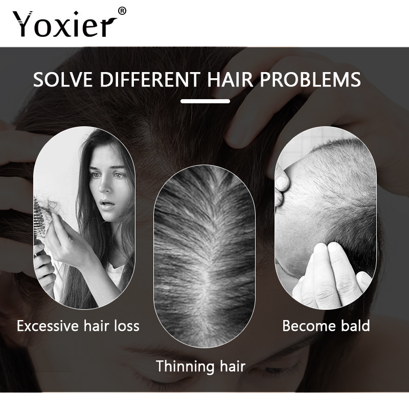 Intensive Growth Serum Prevent - Hair Care For Hair Growth 评论和价格
