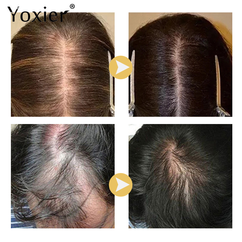 Intensive Growth Serum Prevent - Hair Care For Hair Growth 评论和价格