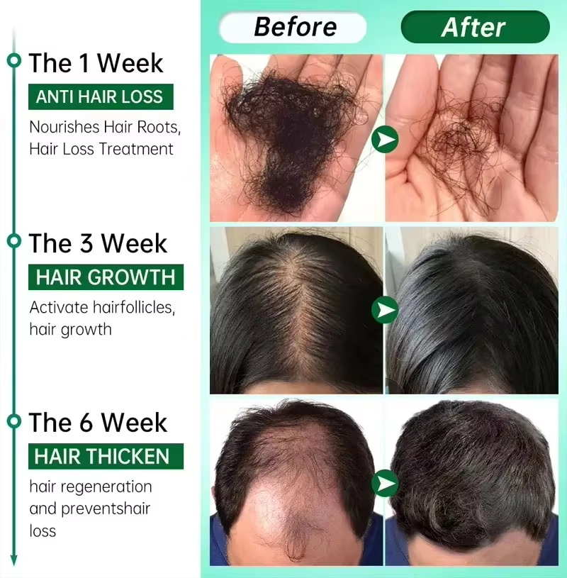 Hair Growth Serum 7 Days Fast  - Hair Care Capsule 评论和价格