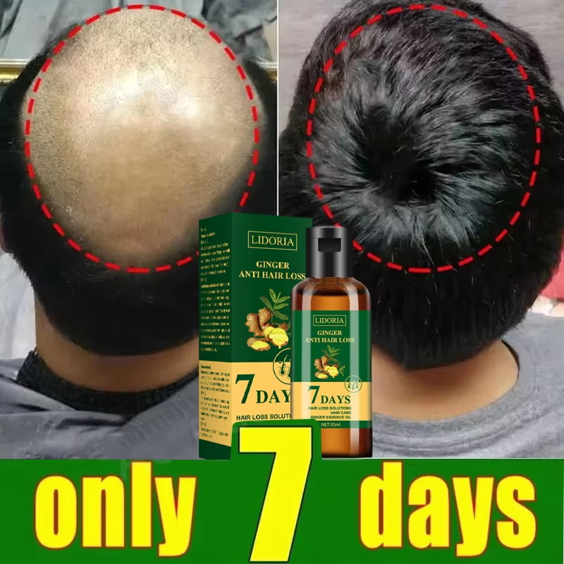 Hair Growth Serum 7 Days Fast  - Hair Care Capsule 评论和价格