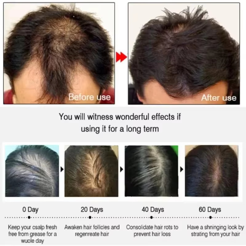 Hair Growth Serum 7 Days Fast  - Hair Care Capsule 评论和价格