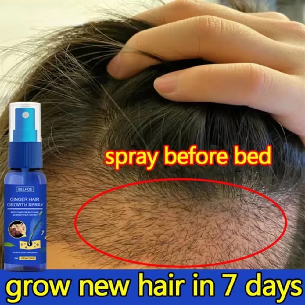 Fast Ginger Hair Growth Spray  - Hair Care For Hair Growth 评论和价格
