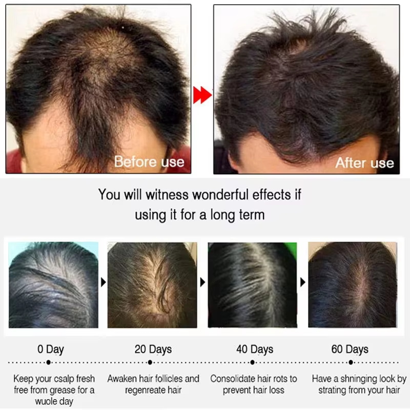 Fast Ginger Hair Growth Spray  - Hair Care For Hair Growth 评论和价格