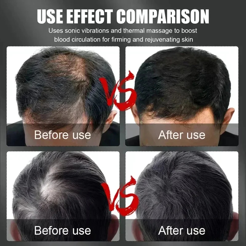 660nm 850nm Red Light Infrared - Hair Care For Hair Growth 评论和价格
